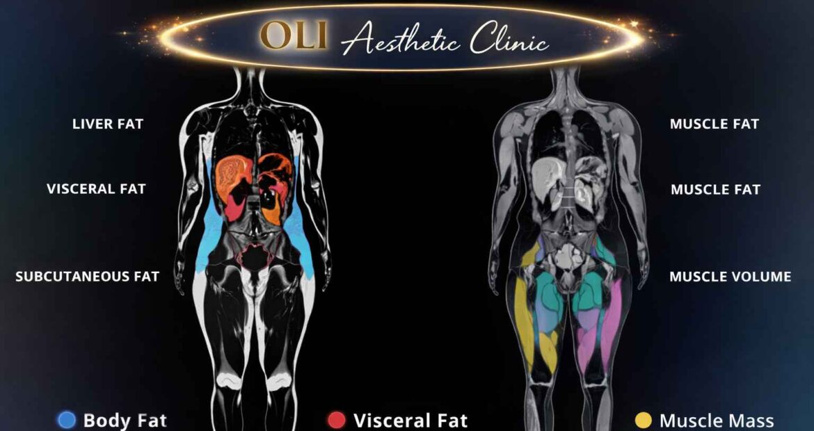 Body mass analysis and profilling Body mass analysis and profilling