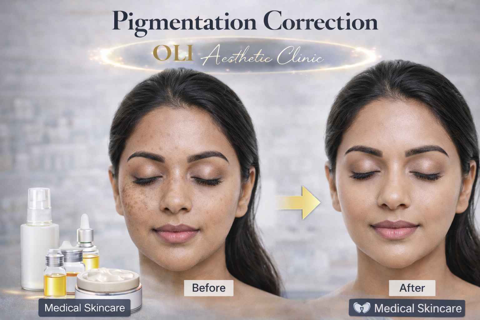 Pigmentation Correction